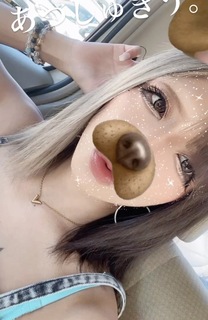 �u���O�摜