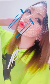 �u���O�摜