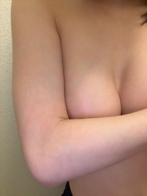 �u���O�摜