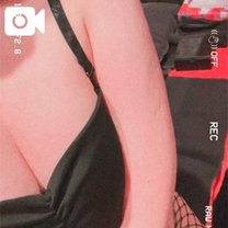 �u���O�摜