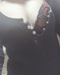 �u���O�摜