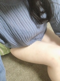 �u���O�摜