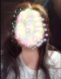 �u���O�摜