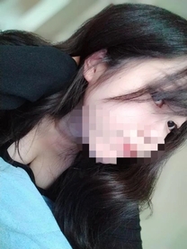 �u���O�摜