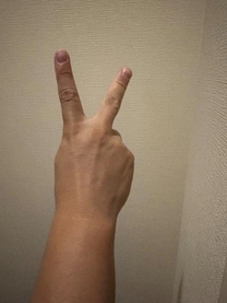 �u���O�摜