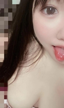 �u���O�摜