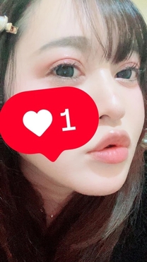 �u���O�摜