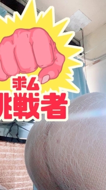 �u���O�摜