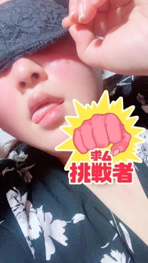 �u���O�摜