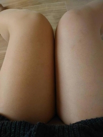 �u���O�摜