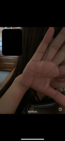 �u���O�摜