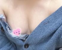 �u���O�摜