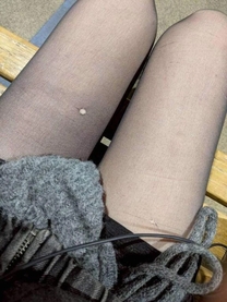 �������̃A��