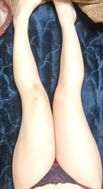 ������āc�H