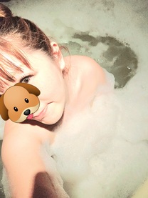 �u���O�摜