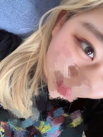 �u���O�摜