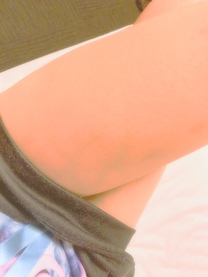 �u���O�摜