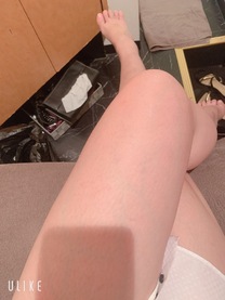 �u���O�摜