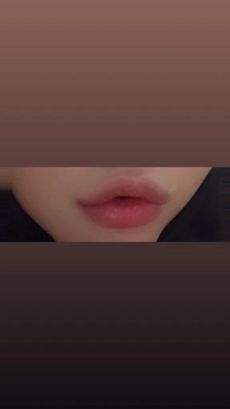 �u���O�摜