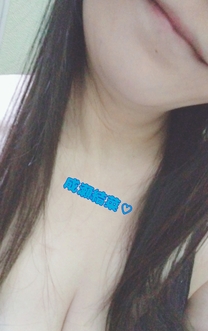 �u���O�摜