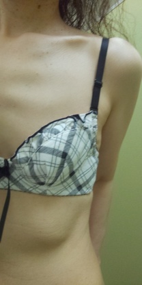 �u���O�摜
