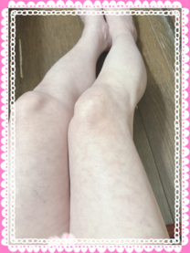 �u���O�摜