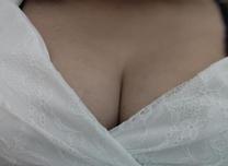 [