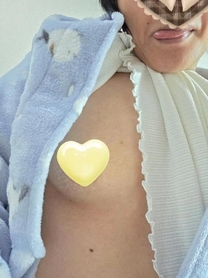 �u���O�摜