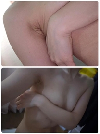 �u���O�摜