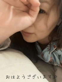 �u���O�摜