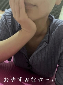 �u���O�摜