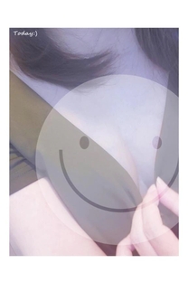�u���O�摜