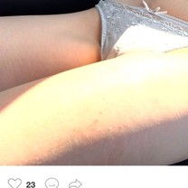 �u���O�摜