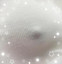 �u���O�摜