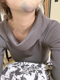 ���ε����β���