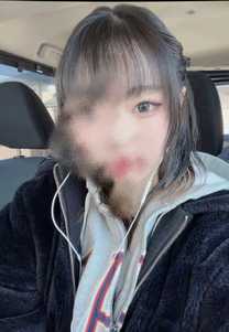 �u���O�摜