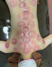 �u���O�摜