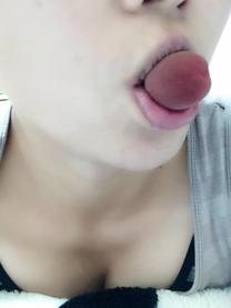 �u���O�摜