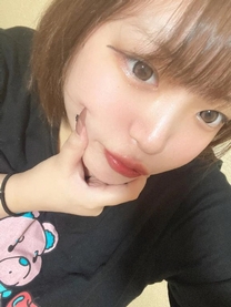 �u���O�摜