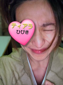 �u���O�摜