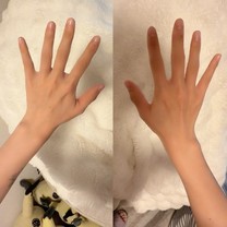 �I�v�V�����̃I�C���}...