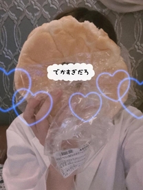 �u���O�摜