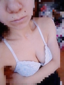 �u���O�摜