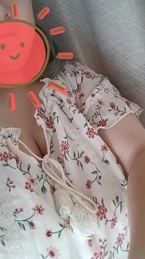 �u���O�摜