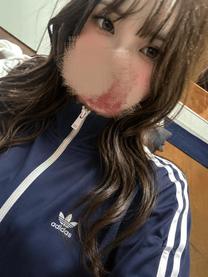 �u���O�摜