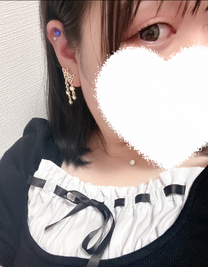 �u���O�摜