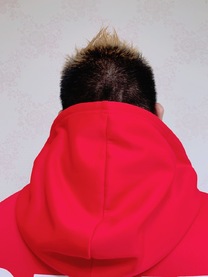 �u���O�摜