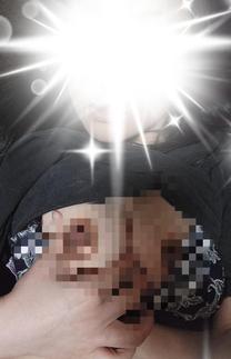 �u���O�摜