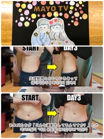 �u���O�摜