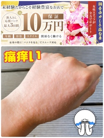 �u���O�摜